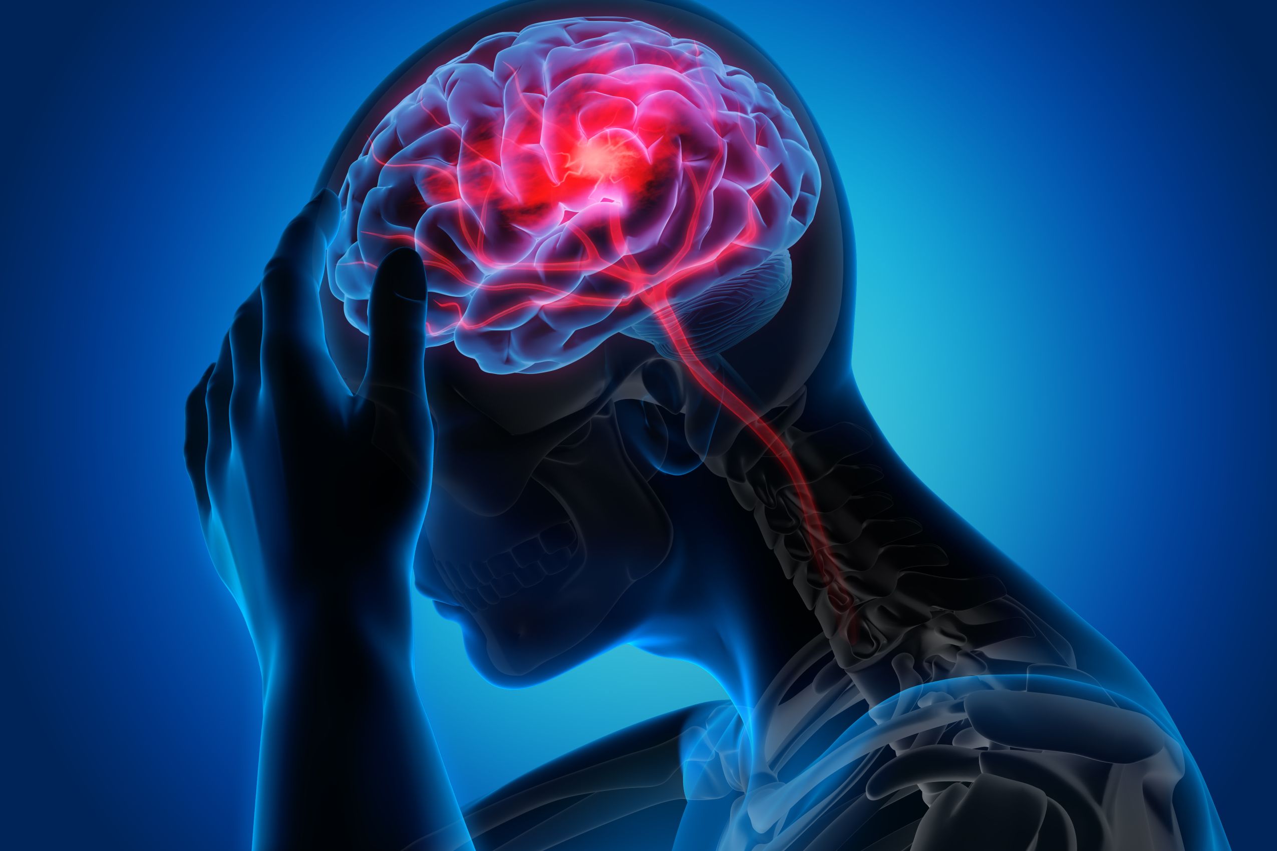 Przyczyny i leczenie bólu głowy